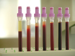 Eigenblut Therapie