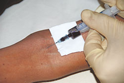Eigenblut Therapie